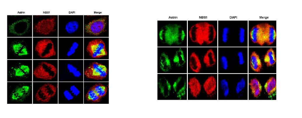 DNA 분열시 NBS1와 과 Astrin의 co-localization