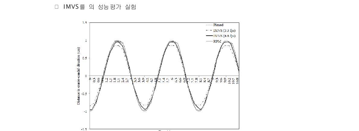 This graph shows the movement of the phantom from cine EPID and RPM system as a function of time.
