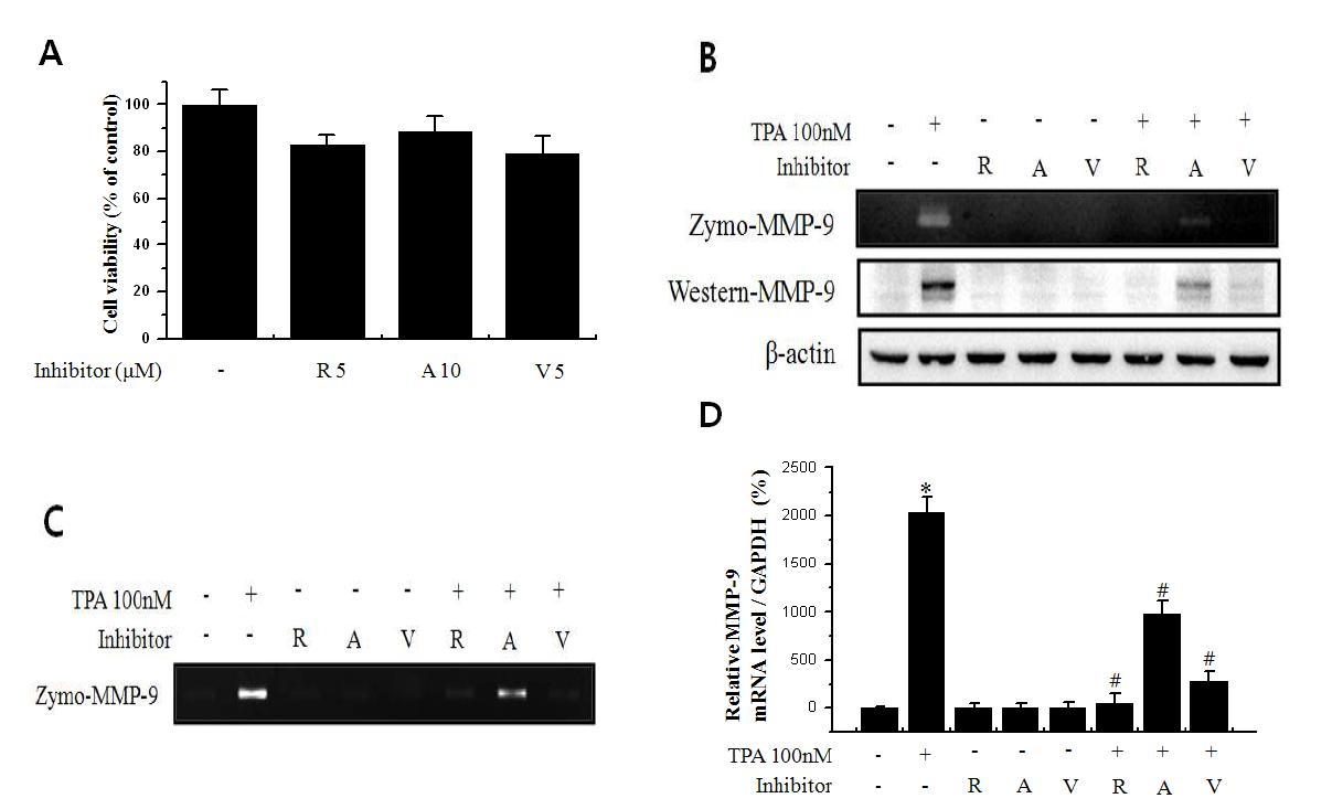 다양한 Aurora kinase 억제제에 의한 MMP-9 발현 억제 효과