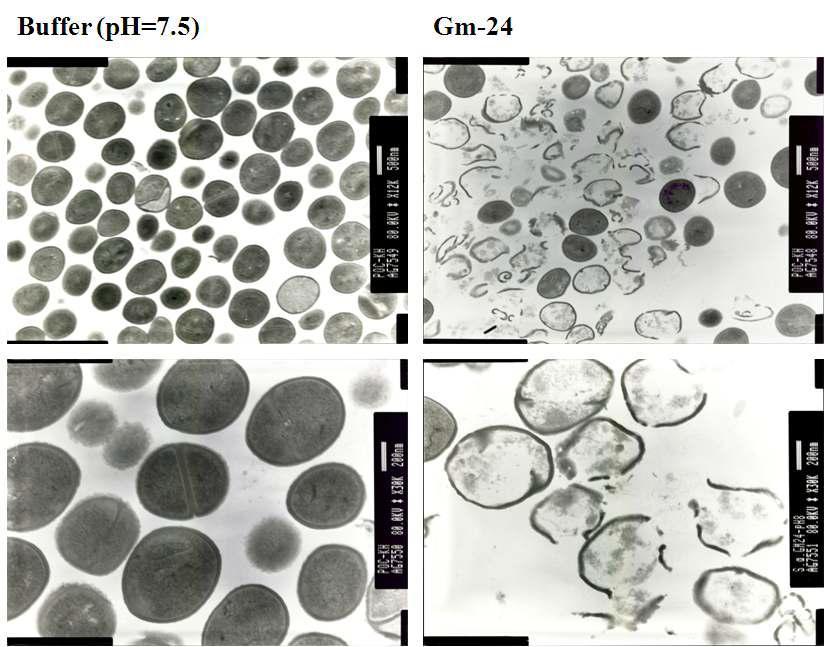 Gm protein-24를 처리한 S. a를 전자현미경으로 관찰