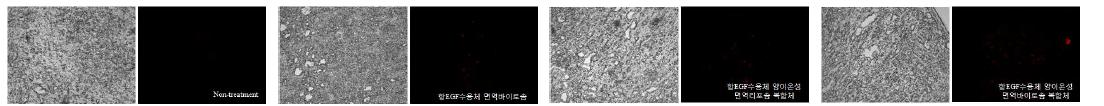 rhodamine 표지 항EGF수용체 면역바이로솜(immunovirosome), 양이온성 면역리포솜복합체(immunolipoplex)와 양이온성 면역바이로솜복합체(immunoviroplex)의 암세포 선택적 전달 (×100)