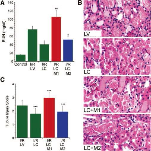 Proinflammatory macrophages promote tubule injury. Mice treated for 2 days with liposomal vehicle (LV) or liposomal clodronate (LC) were subjected to unilateral I/R and contralateral nephrectomy, followed by infusion of 1x106 M1 or M2 macrophagesimmediately after I/R.