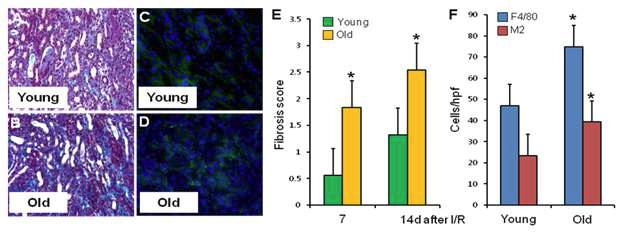 A, B) Masson's trichrome stain of young (A) and old (B) kidneys 14 days after I/R reveals significant fibrosis in both cases, with more areas of extensive fibrosis in the old kidneys. C, D) Immunostaining with F4/80 (green) reveals macrophage persistence in the areas of fibrosis. E) Scoring for fibrosis demonstrates a significantly greater degree of fibrosis in old kidneys as compared to young. n=6, * p<0.01. F) Quantitation of F4/80 and MannoseR+ (M2) macrophages in young and old kidneys 2 weeks after I/R. n=4, p<0.02.