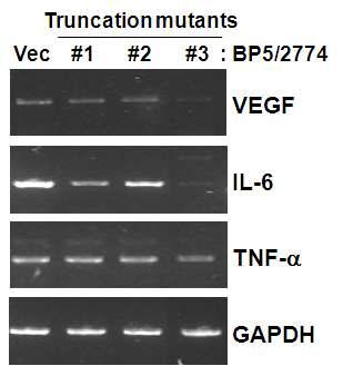 IGFBP-5 Truncation mutant를 발현하는 2774 세포주에서의 RT-PCR 분석