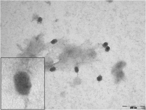 Podoviridae 에 속하는 Acinetobacter phage YMC/B1251 ABA BP 의 EM 사진
