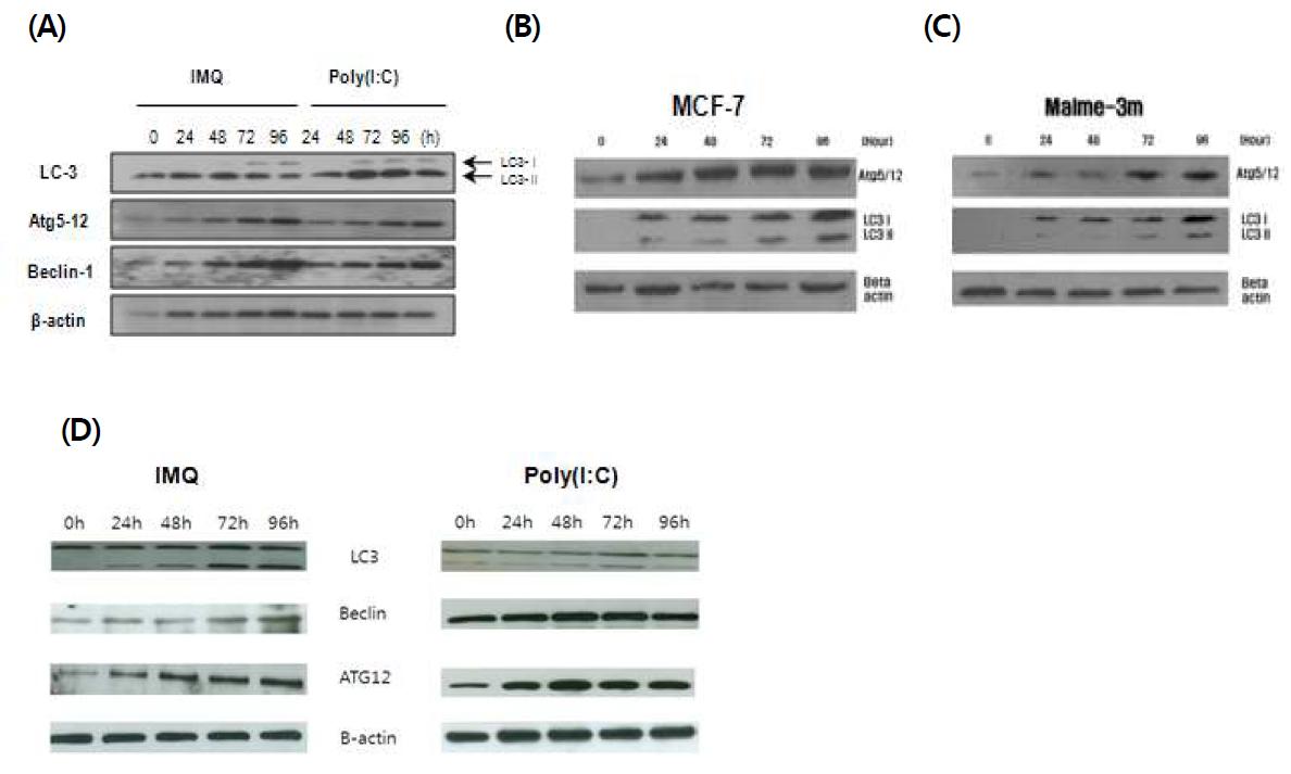 다양한 암세포주에서 TLR 자극물질에 의한 autophagy 확인.