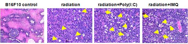 동물 암 조직에서 방사선 조사 전 TLR 자극물질 투여로 autophagy-induced cell death가 촉진되어 조직 내에 비어있는 흰색의 동공(노란화살표 표시)이 발생함을 확인할 수 있다