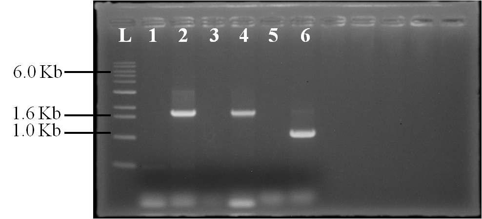 Gel electrophoresis of S. cerevisiae L1L2T10 for target genes (Lane L: 1 Kb ladder, Lane 1, 3, 5 in control strain, Lane 2, 4, 6 in integration strain, Lane 1, 2 for lcb1 gene, Lane 3, 4 for lcb2 gene, Lane 5, 6 for tsc10 gene)