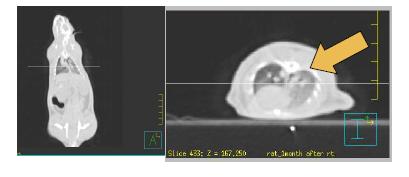 토모테라피 1달 후 CT image