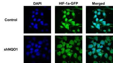 Effect of NQ01 in localization of HIF-1α under hypoxic condition.