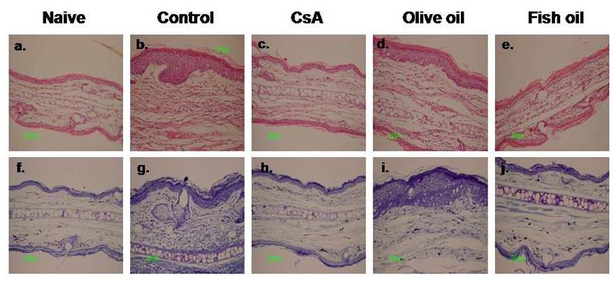 Histological examination of ear lesions in Fish oil (containing high levels of Omega-3 fatty acids) treated NC/Nga mice.