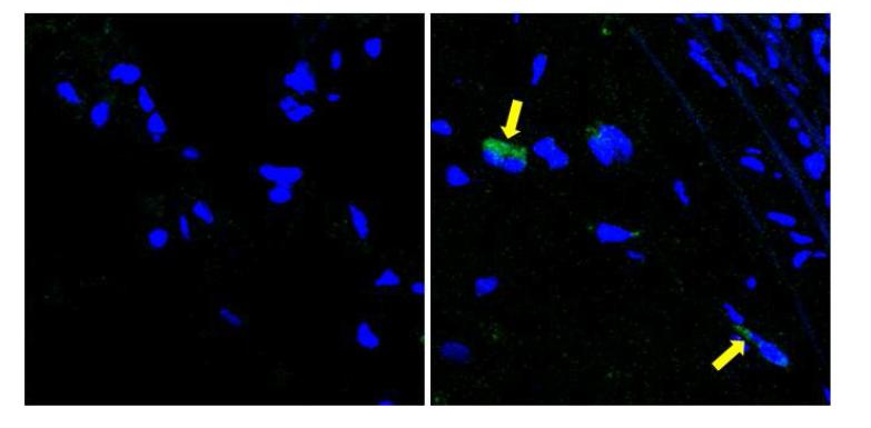 마우스 대동맥의 M1 imaging. 동맥경화 마우스 모델에 M1/M2 대식구로 유도된 세포를 형광으로 표지 후 꼬리정맥으로 주입하여, 5일차에 M1/M2 대식구의 동맥경화반내 유입정도확인