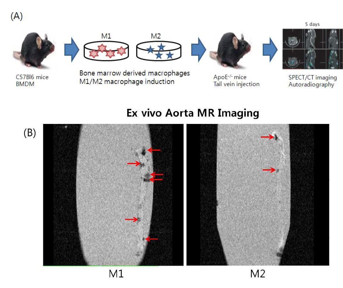 마우스 대동맥의 M1/M2 MRI, SPECT/CT imaging 및 autoradiography