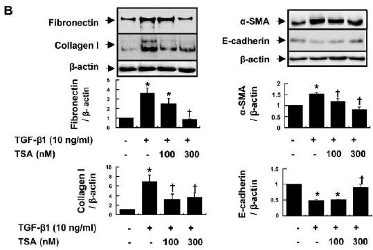 Fig. 7. Inhibition effect of HDAC inhibitor on myofibroblast differentiation in renal fibroblast