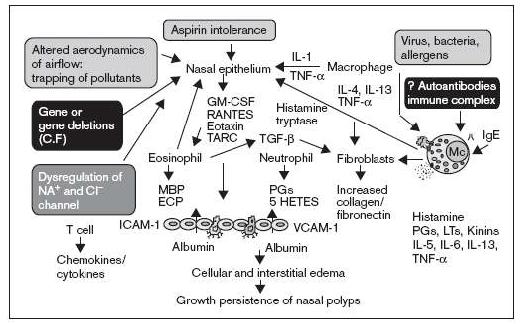 Fig. 1. Pathogenesis of nasal polyps