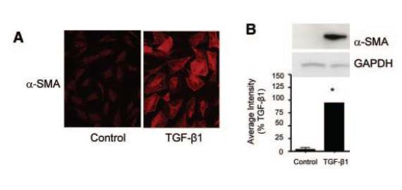 Fig. 3. TGF-β1-induced kidney myofibroblast differentiation