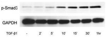 Fig. 5. TGF-β1-induced Smad3 activation in kidney fibroblast