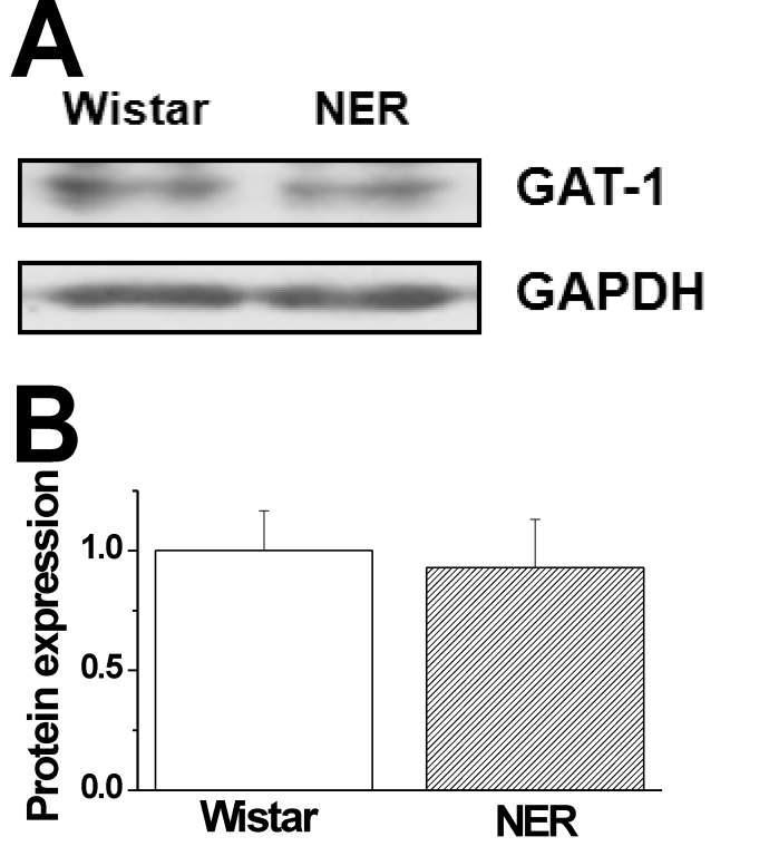 Comparison of GABA transporter 1 expression in WIS and NER.