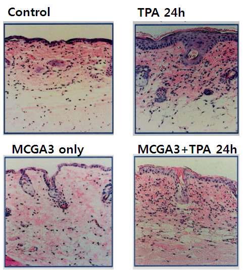 Inhibitory effect of MCGA3 on TPA-induced hyperplasia in CD-1 mice. Twenty-four after treatment of TPA or MCGA3 or TPA+MCGA3, the animals were sacrificed; skin biopsies were processed for hematoxylin and eosin staining.