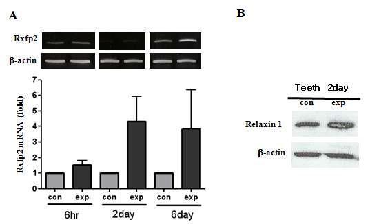 Expression of rxfp2 in the tooth after orthodontic application. (a) The transcriptional level of relaxin increased a lot immediately after birth. Also, the level increased during orthodontic treatment in a time-dependent manner. (b) The protein level of relaxin 1 was also increased by the orthodontic movement for 2 days.