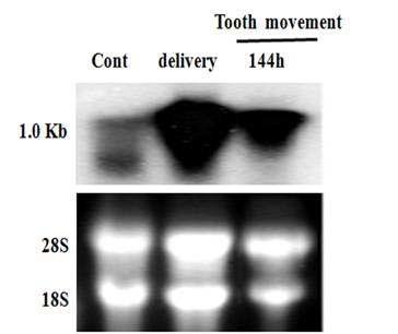 Rln-1 mRNA expression induced by orthodontic force.