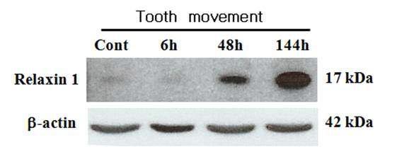 Rln-1 protein was induced by orthodontic force and assessed by Western blot analysis at 6 h, 48 h and 144 h after orthodontic appliance. The protein level increased in a time-dependent manner.