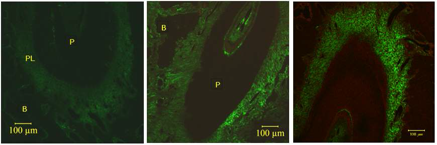 Relaxin expression-induced by orthodontic force in periodontal ligament.