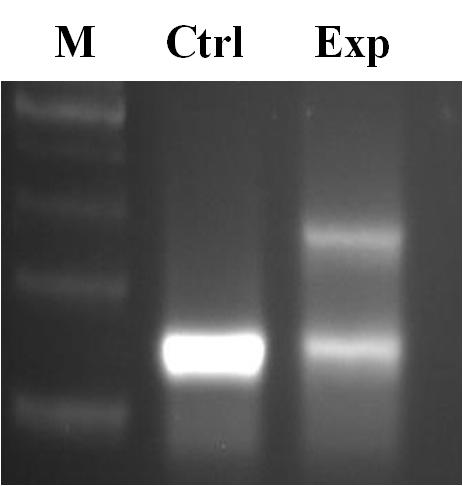 Result of DD-PCR using the specific primer ACP22, demonstrated differentially expressed band (arrow) sized about 300 bp, was observed at tooth movement group. The molecular marker (M) is a 100 bp ladder.