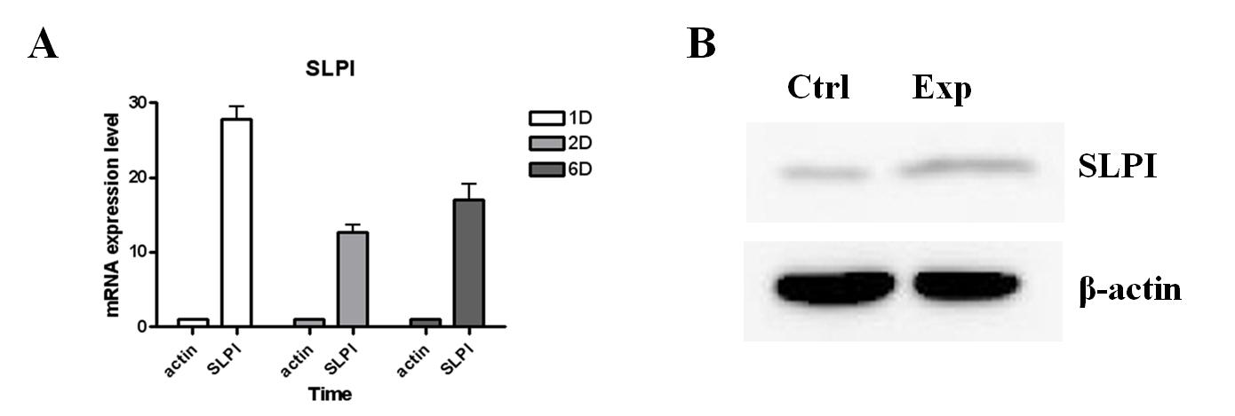 SLPI expression is induced by orthodontic force in both mRNA and protein level. (A)The mRNA expression level was assessed using real time RT-PCR. After applying the orthodontic force, the expression level of SLPI increased 28-, 13- and 17-fold at tooth movement after 1day, 2days and 6days, respectively. Data (mean ± SD) were assessed from 3 independent experiments. (B) Western blot also confirmed that SLPI protein increased after tooth movement for 1 day.