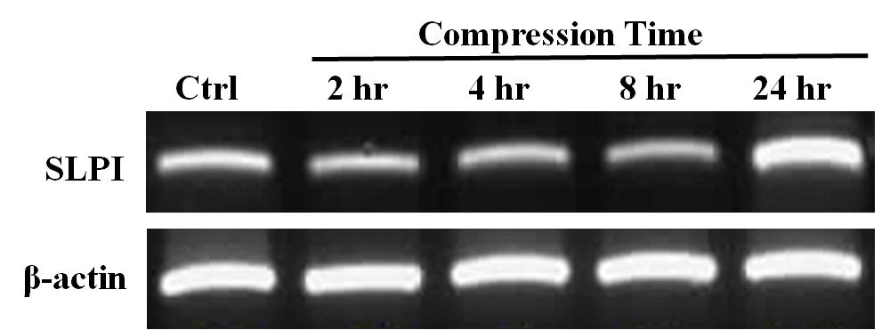 The expression of SLPI on human PDL compression model was also determined by RT-PCR. Fresh human premolar teeth extracted for orthodontic reasons are used for primary culture of PDL, and they were compressed by titanium disk weighed 34g for 2, 4, 8, and 24hr. SLPI was significantly increased at 24hr compression sample
