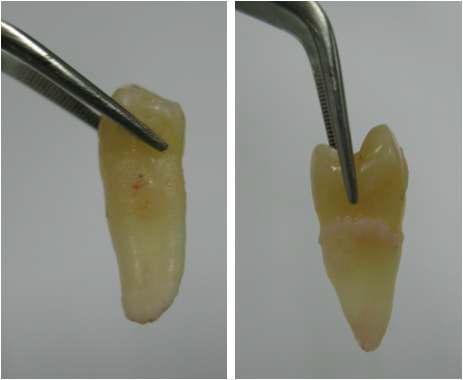 Collecting of human teeths from patients