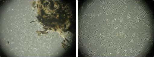 Primayr periodontal ligament cells from human teeths