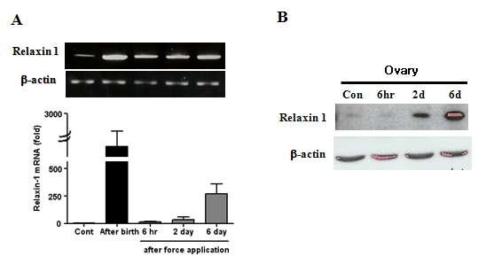 Expression of relaxin 1 in the ovary after orthodontic application. (a) The transcriptional level of relaxin increased a lot immediately after birth. Also, the level increased during orthodontic treatment in a time-dependent manner. (b) The protein level of relaxin 1 also increased in a time-dependent manner.