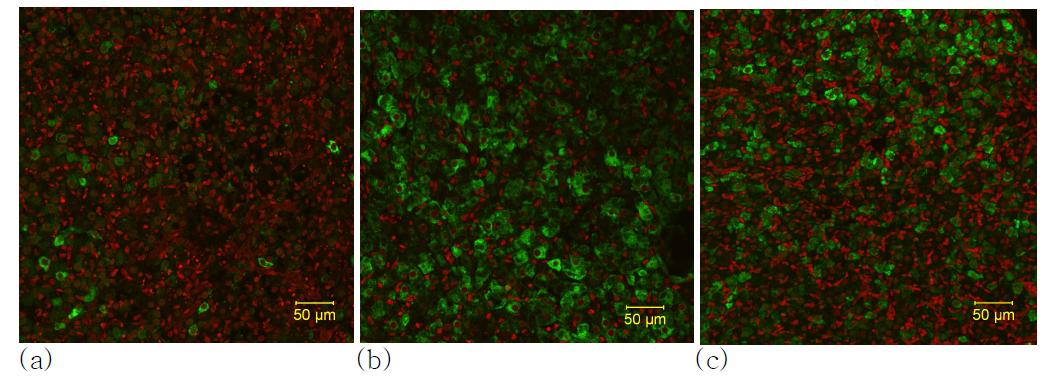 Immunofluorescence for the detection of realxin in rat ovary. Immunofluorescence is seen in granulosa cells. (a) control, (b) immediately after delivery (c) after orthodontic force for 2 days
