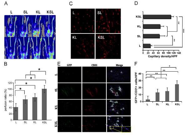 hind-limb ischemia에서 cKit+/Sca-1+/Lin- (KSL)세포 의 혈관세포로의 분화도