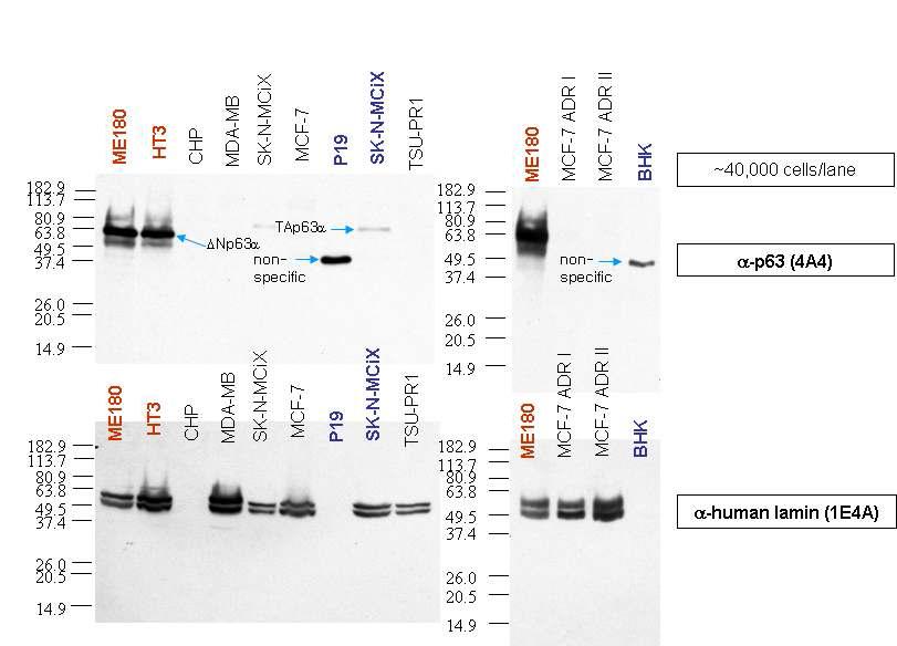 Neuroblastoma cell line인 MC-ixC (SK-N-MCiX) 세포에서 endogenous TAp63α이 매우 낮은 농도로 발현 하고 cervical carcinoma cell line인 ME180, HT3 암 세포에서 Np63α isoform이 높은 농도로 발현함.