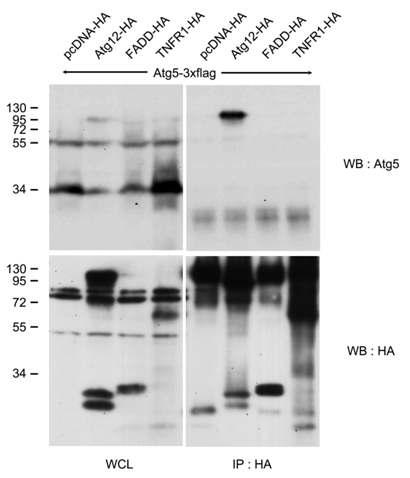 Atg5와 TNFR1의 상호결합 조사