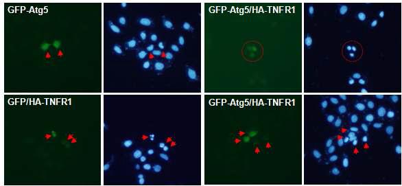 Autophagy 및 apoposis inhibitor에 의한 Atg5와 TNFR1 죽음 변화