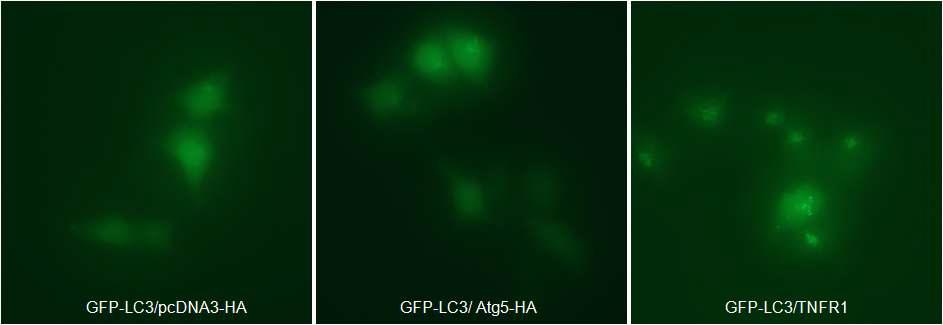 Atg5와 TNFR1에 의한 autophagosome 형성 관찰
