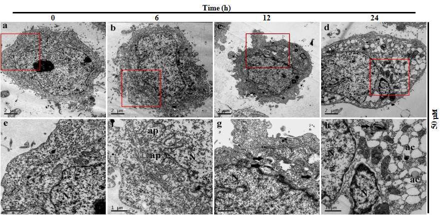 R epresentative electron micrographs of cells incubated with 50 μM DHA for various time.