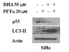 p53 inhibition triggers autophagy and enhances DHA -induced LC3 expression.
