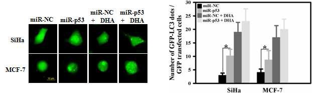 p53 knockdown triggers autophagy and enhances DHA -induced autophagic activation.