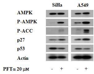 W estern blot analysis of the AM PK /mTOR signaling molecules in SiHa and A 549 cells in the presence or absence of PFT α.