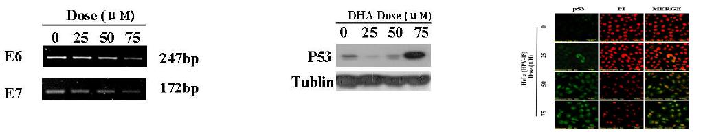 Effect of DHA on HPV-18 E6/E7 and p53 expression in HeLa cells.