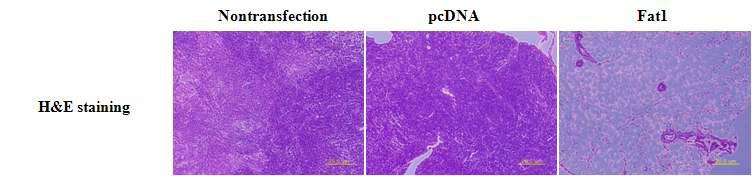 w3-desaturase expressing SiHa stable cells inhibit tumor formation in vivo compared topcDNA transfected and nontransfected parent control cells, as assessed by H&E staining assay.