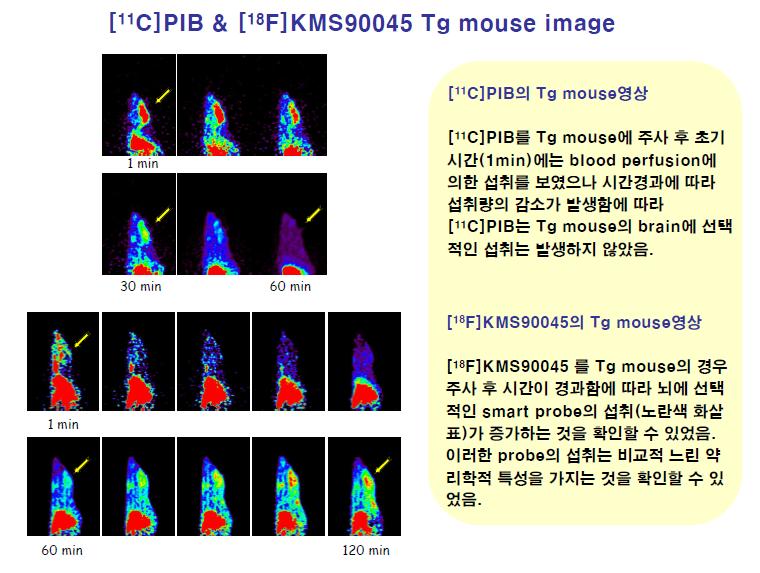 형질변환 동물모델을 이용한 [11C]PIB 및 [18F]KMS90045의 micro-PET 영상