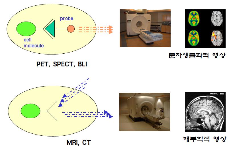 PET, SPECT와 MRI, CT의 원리 및 차이점