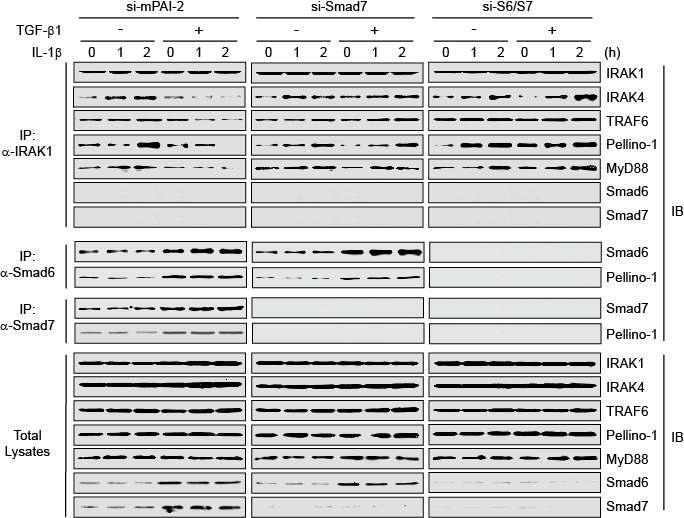 Smad7 knock-down (si-Smad7)와 Smad7/Smad6 double knock-down (si-S6/S7) 마우스 복강유래 대식세포주, 그리고 control 세포주(si-mPAI2)에서 TGF-β에 의한 IRAK1-mediated signaling complex 형성 여부 분석. endogenous IRAK1, Smad6, Smad7에 대한 항체를 이용하여 면역침전한 후 각각의 신호전달 단백질을 western blot으로 확인