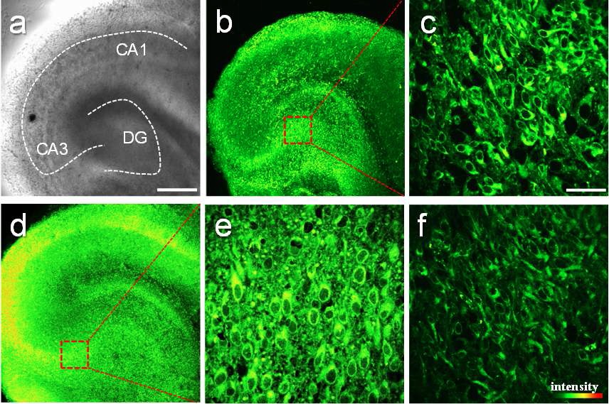 Figure 25. Images of fresh hippocampal slice of 2-dayold rat stained with 20 mM ACu1. (a) Bright-fieldimage of CA1-CA3 regions as well as the dentate gyrusby 10´ magnification. TPM image by 10´ magnificationwith (b) untreated and (d) pretreated with 1 mM CuCl2.15 TPM images were accumulated along thez-directionatadepthofapproximately90-220 mm. Scale bar,300 mm. (c,e) TPM image in the DG region (red box)of (b,d) at a depth of ~100 mm by magnification at100´. Scale bar, 30 mm. (f) TPM image of (c) treatedwith 10 mM TAHD. The TPEF were collected at400-620 nm upon excitation at 750 nm with afemtosecond pulse.