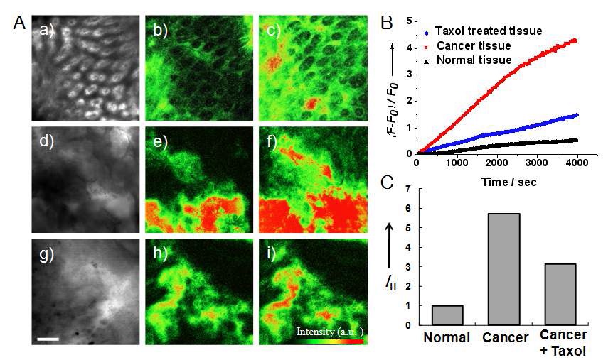 Figure 41. (A) Images of normal tissue (a, b, c), cancer tissue (d, e, f), andcancer tissue treated with taxol (g, h, i). Normal tissues were incubated in ACSFfor 4 h, and cancer tissues were incubated in the absence and presence of taxol(50 μM) in ACSF for 4 h, after which AG2 uptake was monitored. a, d, and gare bright-field images; b, e, and h are pseudocolored TPM images obtainedafter incubation with AG2 for 4,000 s; and c, f, and i are pseudocolored TPMimages obtained after incubation with AG2 for 4 h. The TPM images wereobtained at a depth of 100 μm by collecting the TPEF spectra in the range of520?620 nm on excitation with fs pulses at 780 nm. Scale bar, 30 mm. (B)Time course of AG2 uptake by normal tissue, cancer tissue, and cancer tissuetreated with taxol (50 μM) at 100-μm depth as a function of time. (C) RelativeAG2 uptake by normal tissue, cancer tissue, and cancer tissue treated with taxol(50 μM) for 4,000 s. The columns indicate the sum of the TPEF intensitiesmeasured by PMT at depths of 75, 100, 125, and 150 μm from the tissuesurface, relative to that of normal tissue. The data are the average of 3independent experiments.
